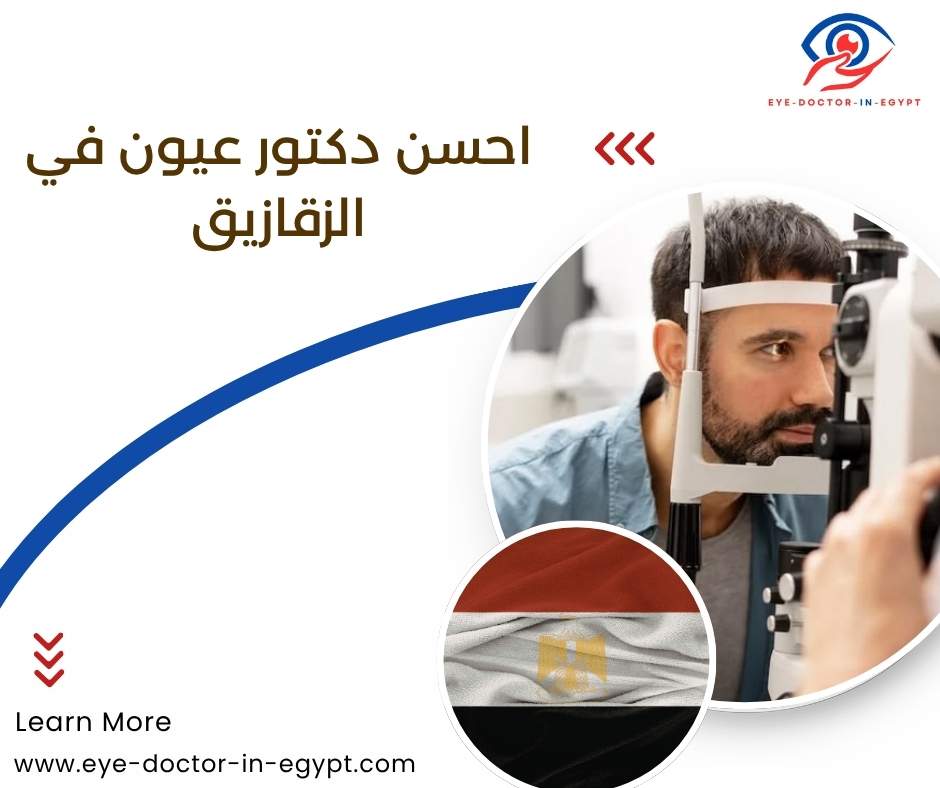 احسن دكتور عيون في الزقازيق