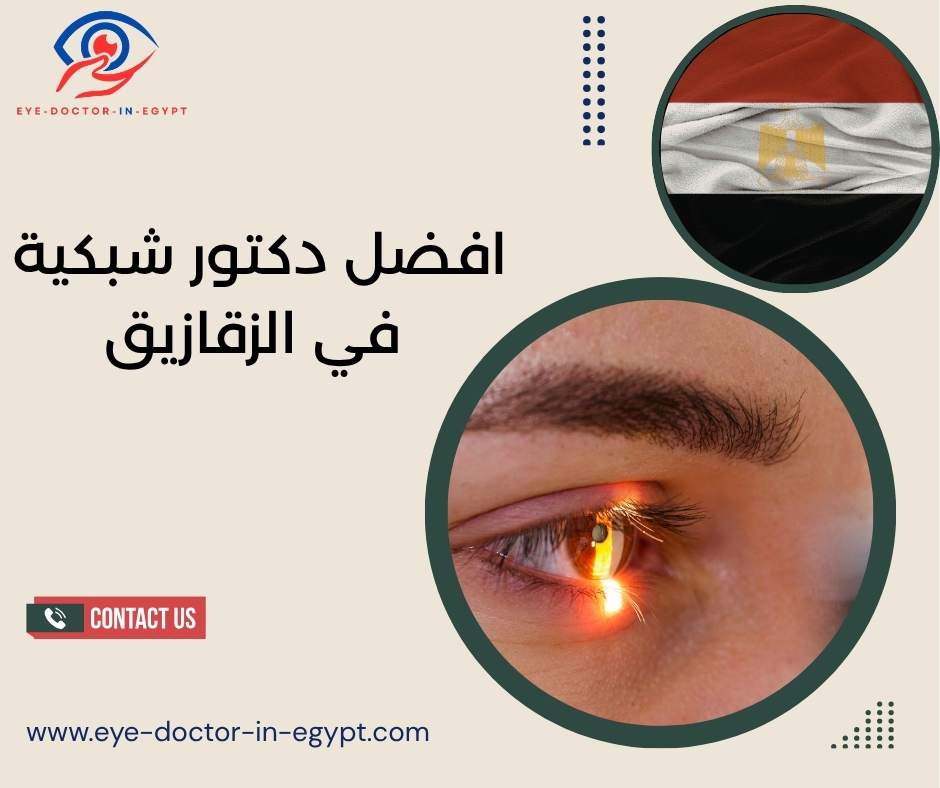 افضل دكتور شبكية في الزقازيق