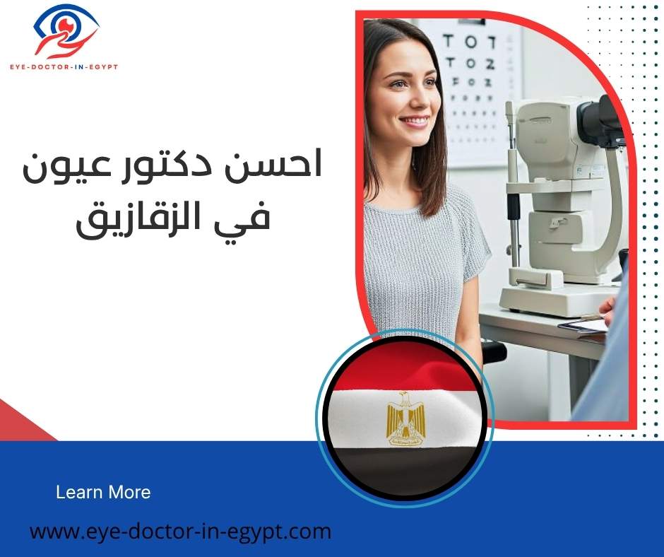 احسن دكتور عيون في الزقازيق