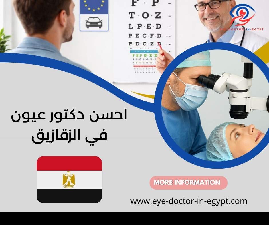احسن دكتور عيون في الزقازيق