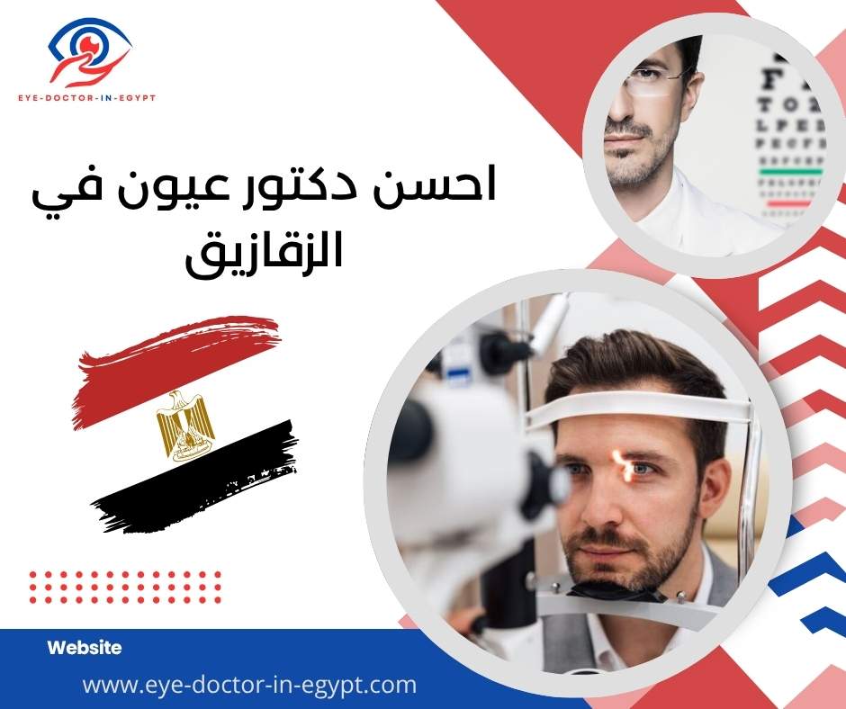 احسن دكتور عيون في الزقازيق