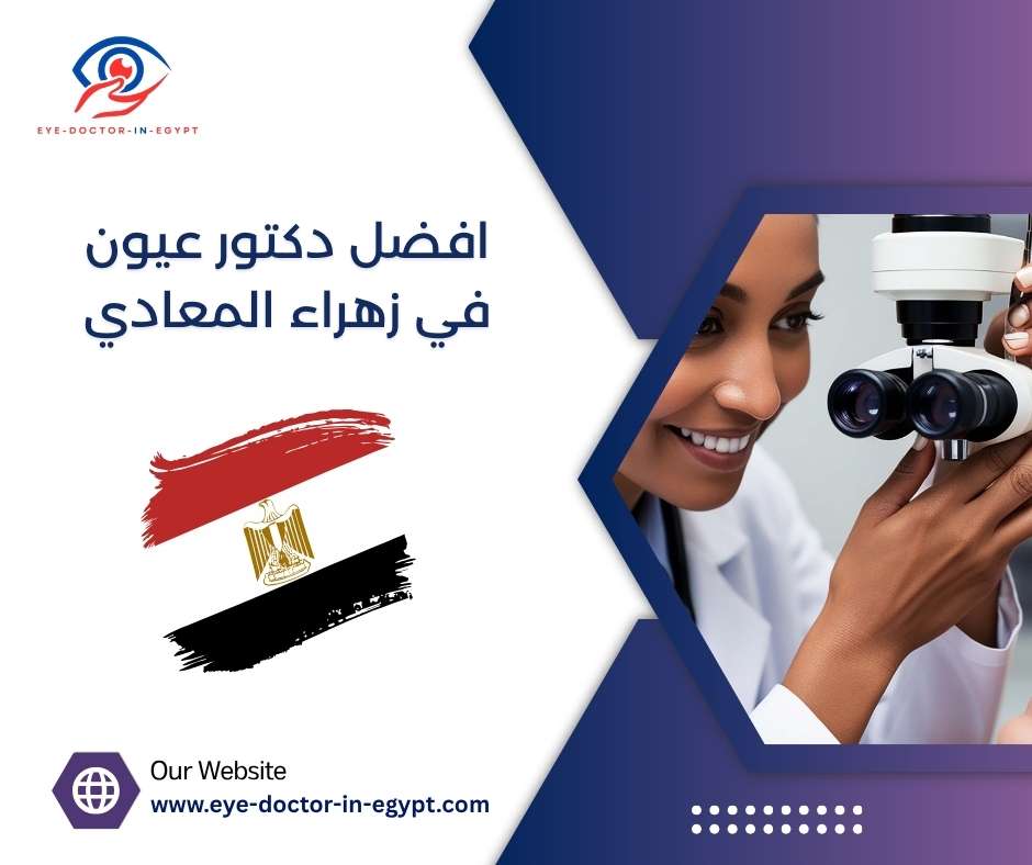 افضل دكتور عيون في زهراء المعادي
