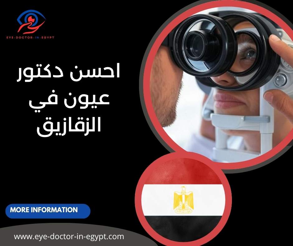 احسن دكتور عيون في الزقازيق