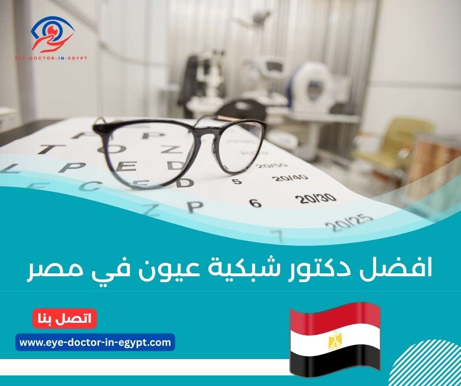افضل دكتور شبكية عيون في مصر