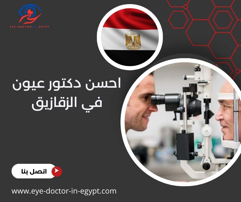 احسن دكتور عيون في الزقازيق