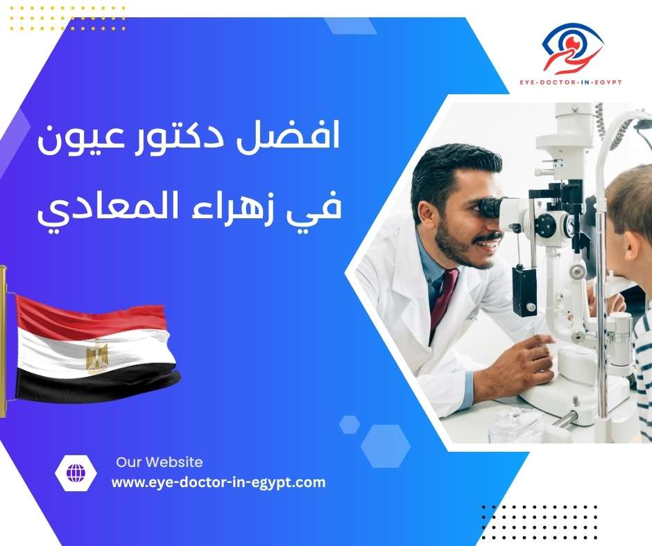 افضل دكتور عيون في زهراء المعادي