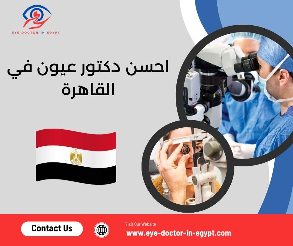 احسن دكتور عيون في القاهرة