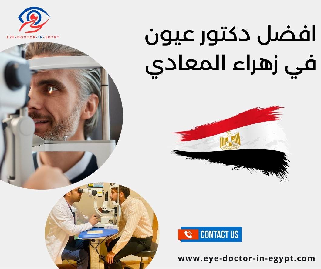 افضل دكتور عيون في زهراء المعادي