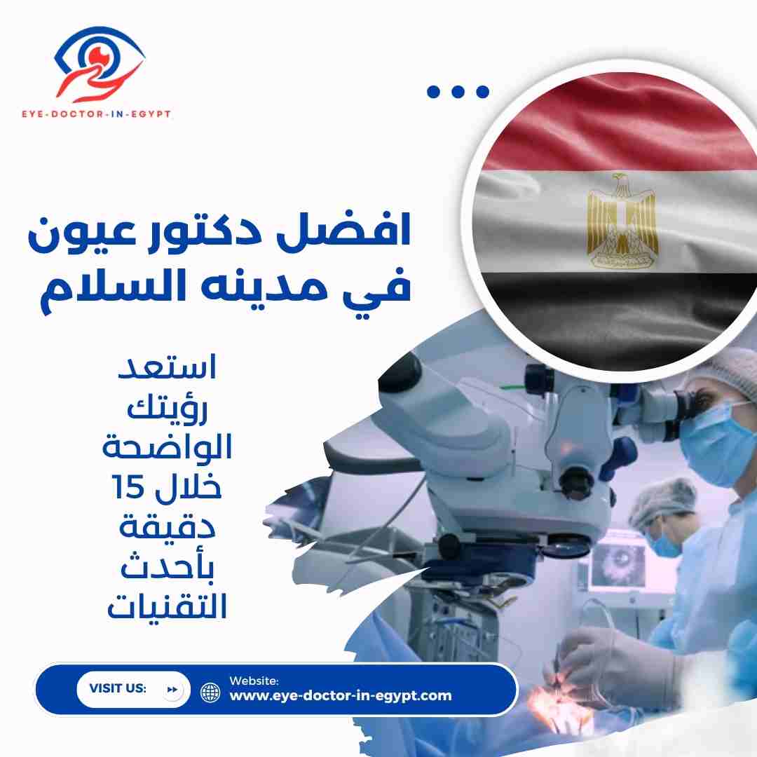 افضل دكتور عيون في مدينه السلام