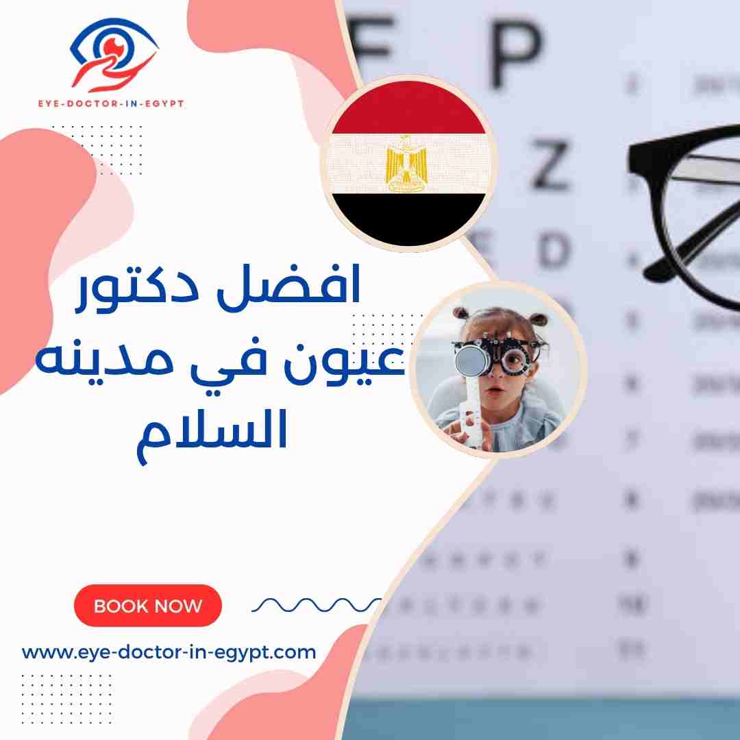 افضل دكتور عيون في مدينه السلام