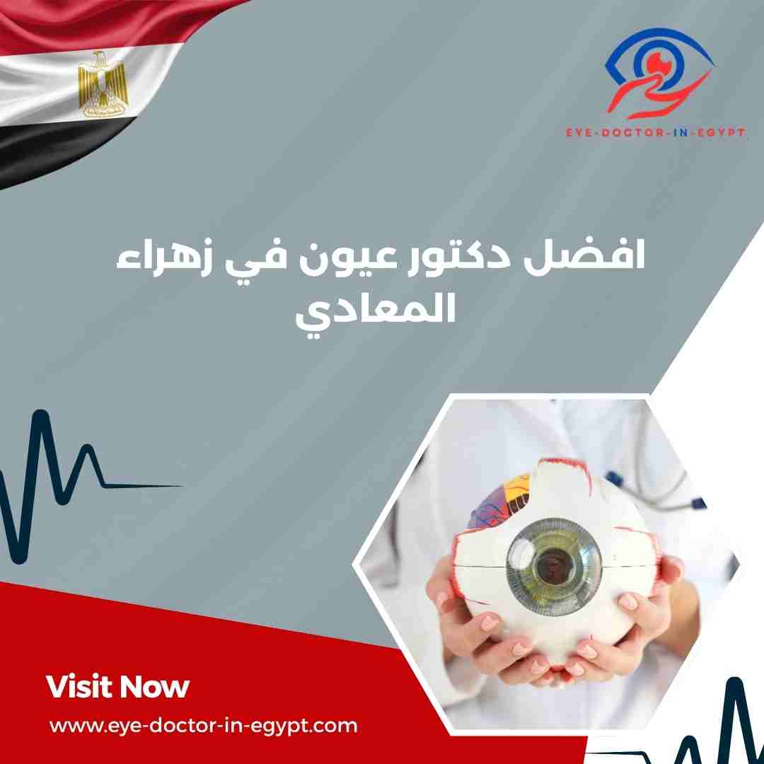 افضل دكتور عيون في زهراء المعادي