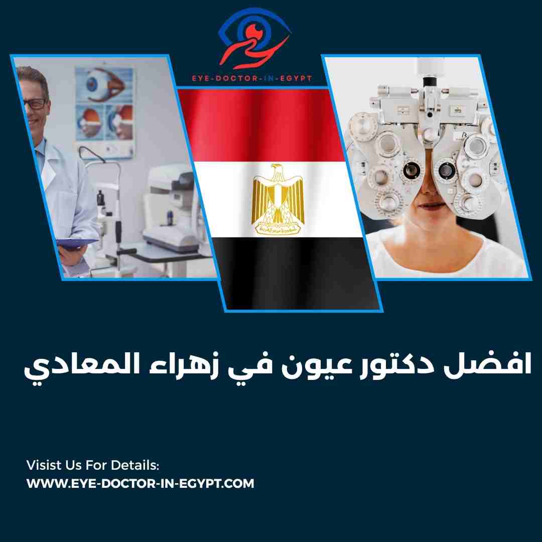 افضل دكتور عيون في زهراء المعادي