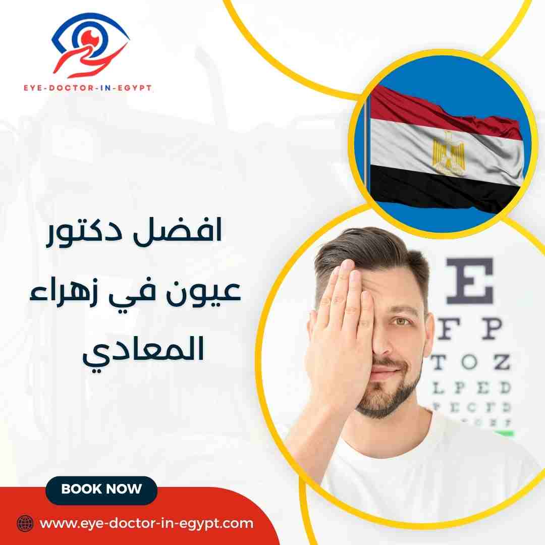افضل دكتور عيون في زهراء المعادي