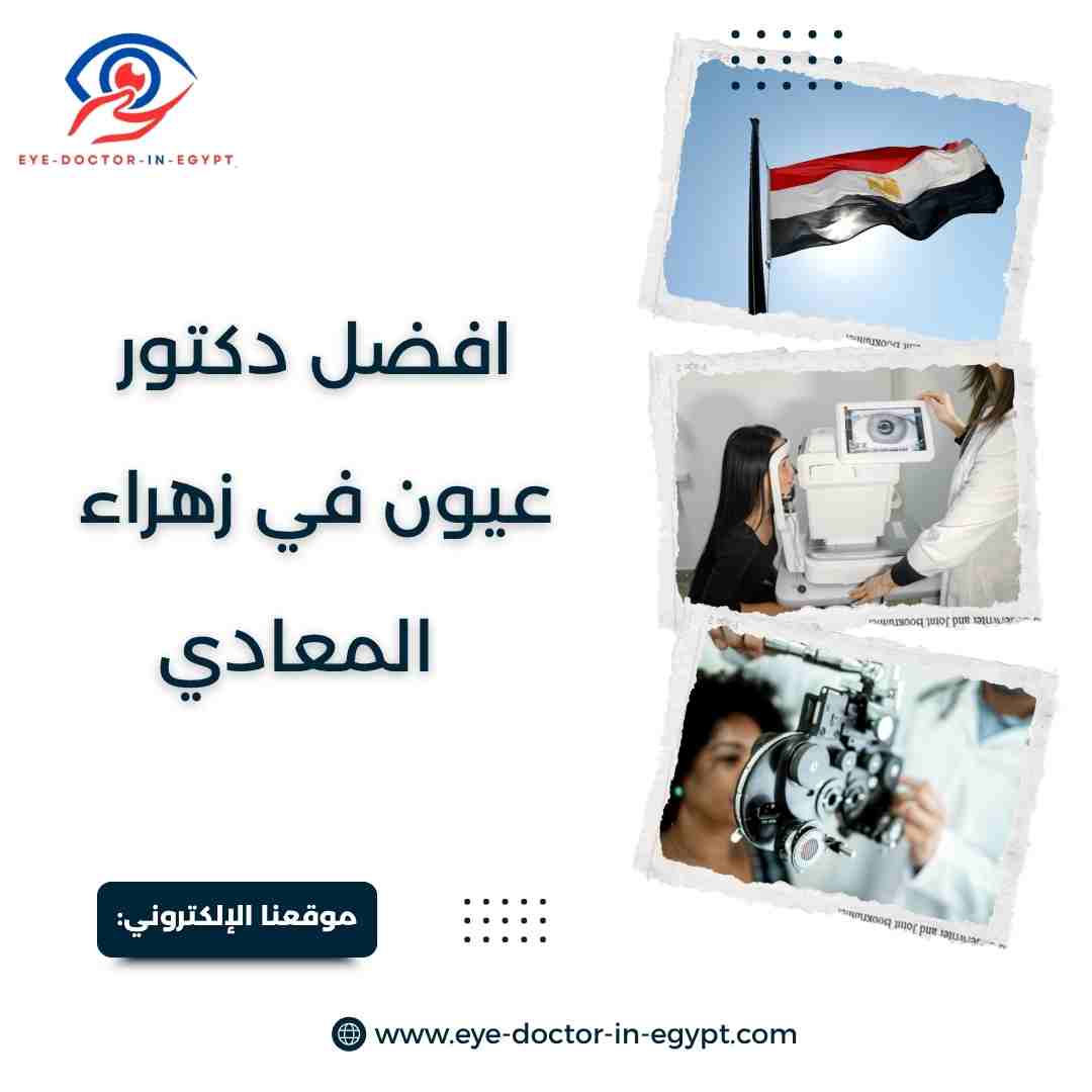 افضل دكتور عيون في زهراء المعادي