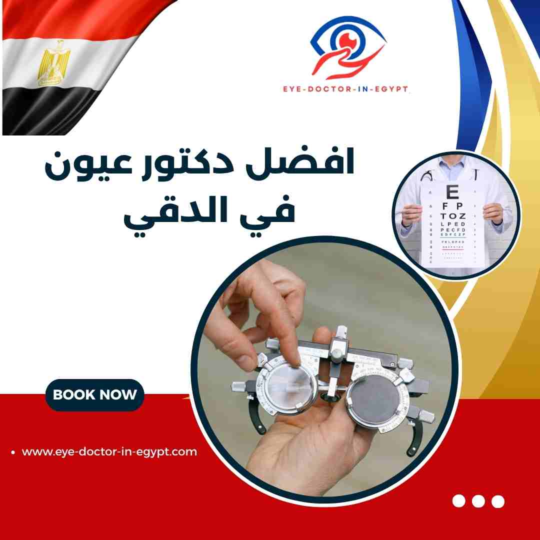 افضل دكتور عيون في الدقي