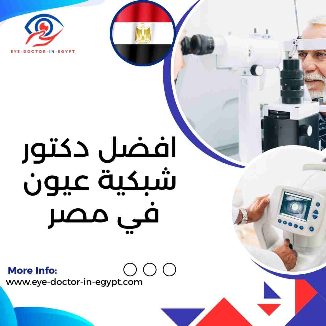 افضل دكتور شبكية عيون في مصر
