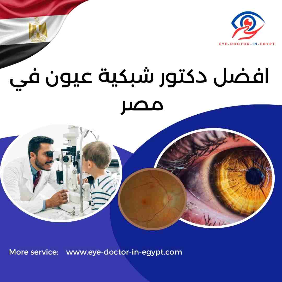 افضل دكتور شبكية عيون في مصر