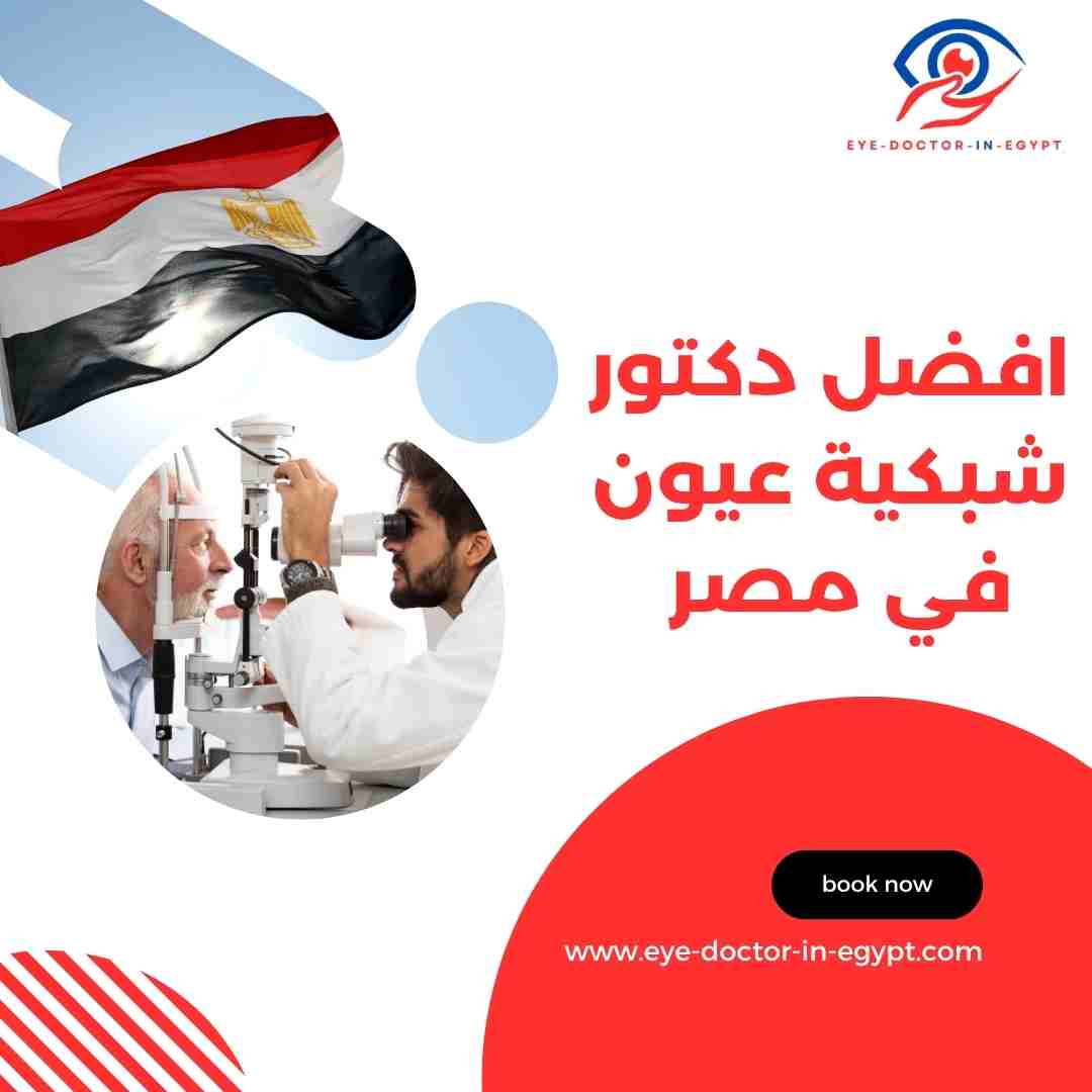 افضل دكتور شبكية عيون في مصر
