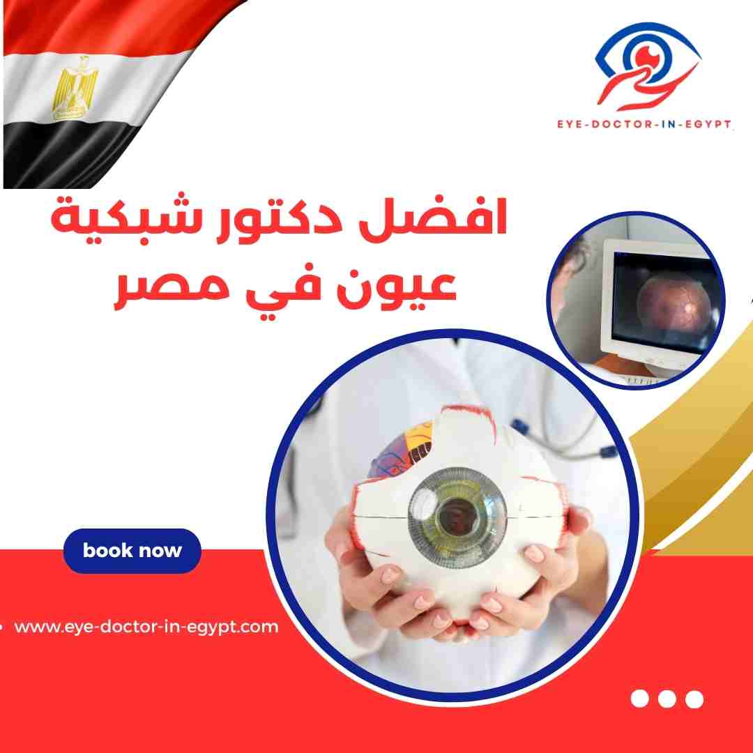 افضل دكتور شبكية عيون في مصر