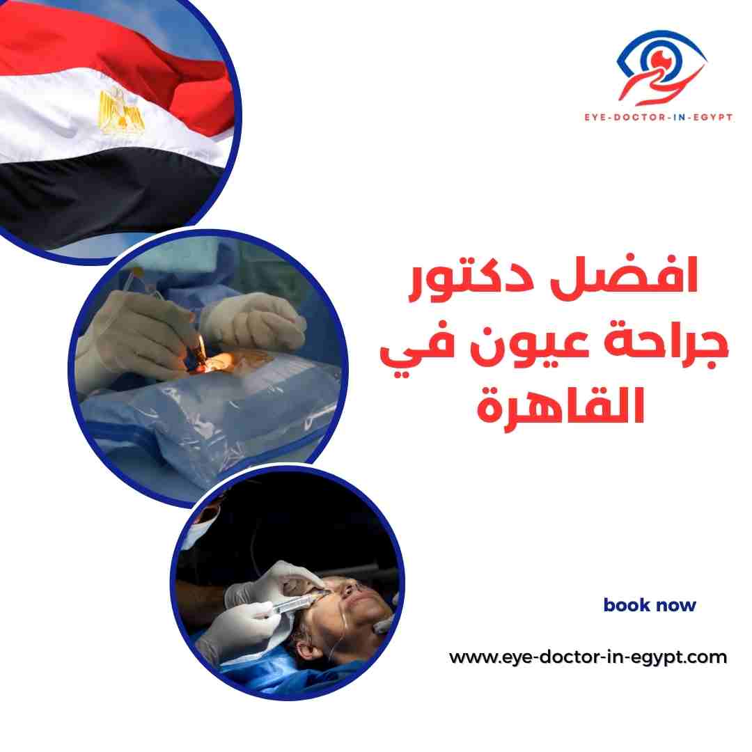 افضل دكتور جراحة عيون في القاهرة