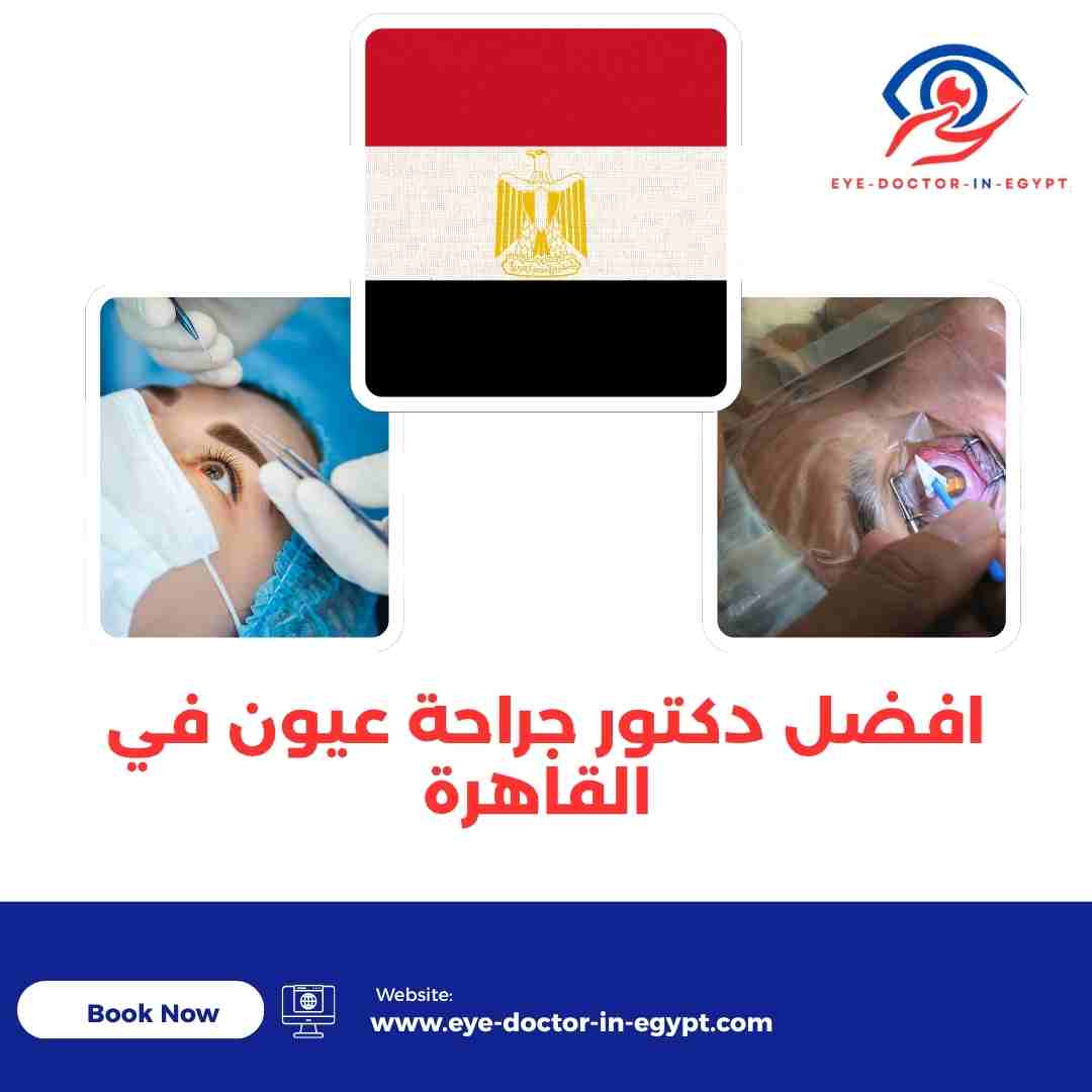افضل دكتور جراحة عيون في القاهرة