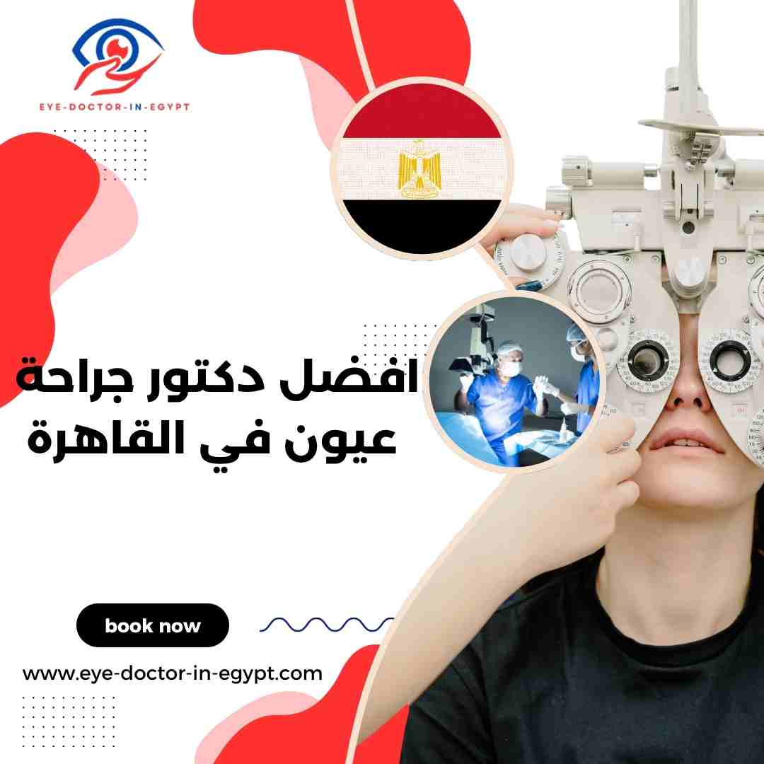 افضل دكتور جراحة عيون في القاهرة