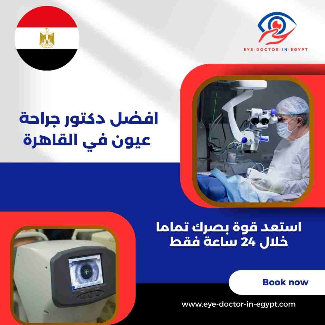افضل دكتور جراحة عيون في القاهرة