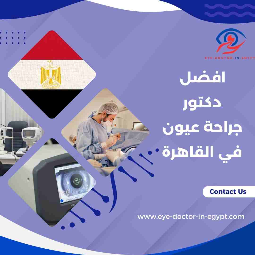 افضل دكتور جراحة عيون في القاهرة