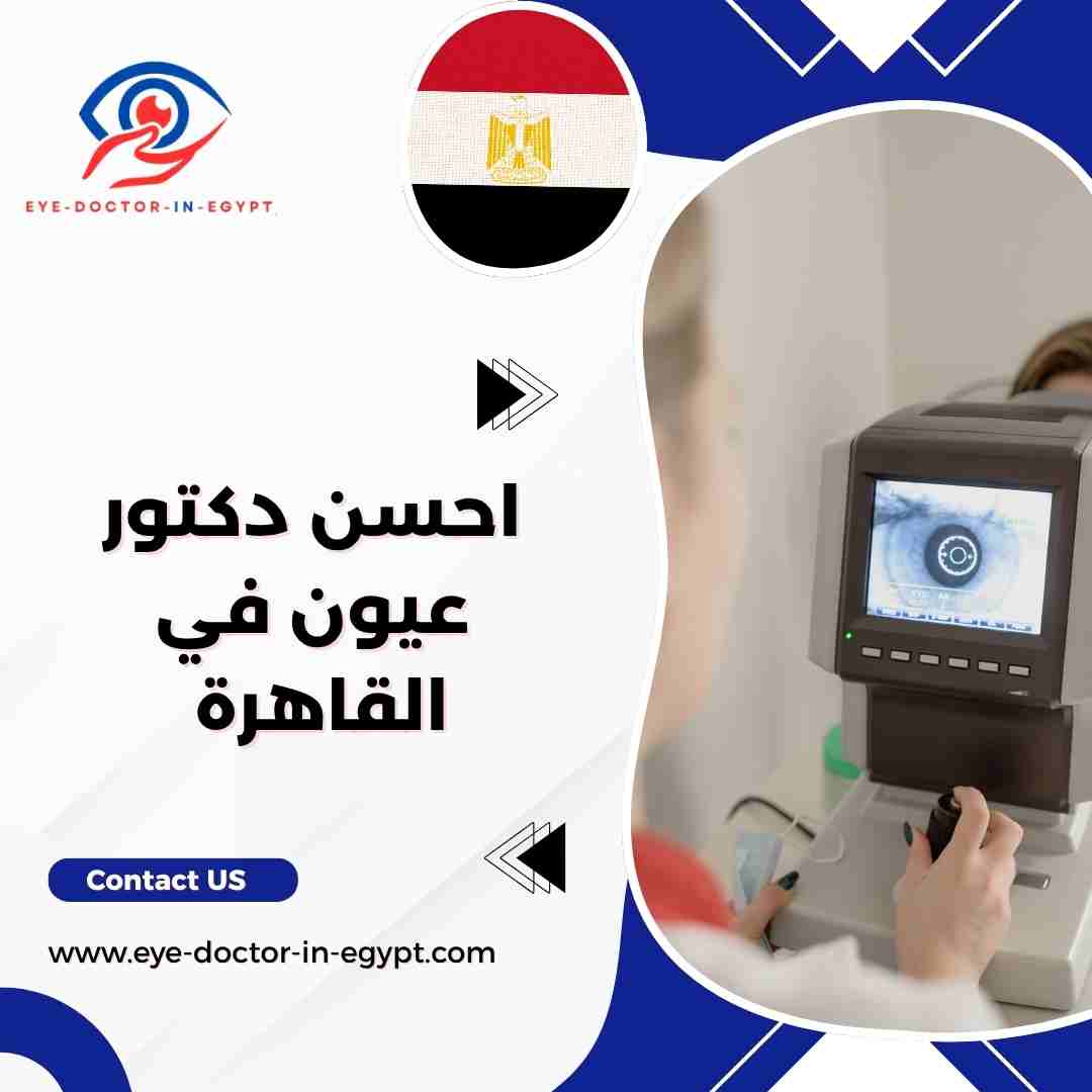 احسن دكتور عيون في القاهرة