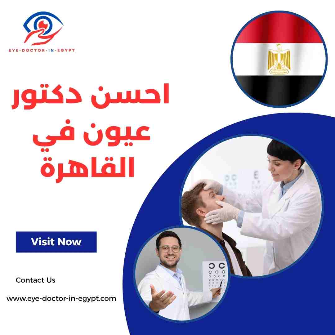 احسن دكتور عيون في القاهرة