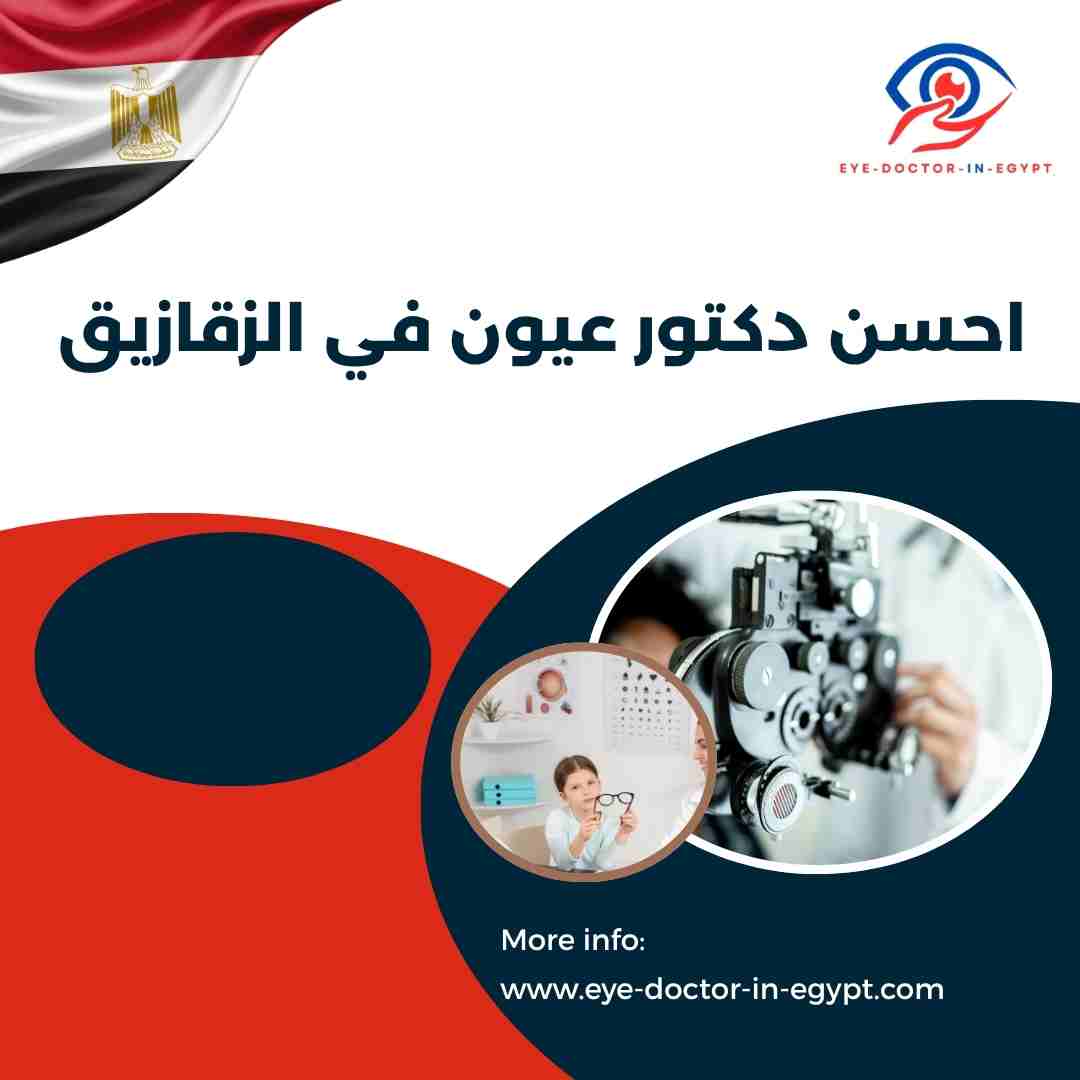 احسن دكتور عيون في الزقازيق