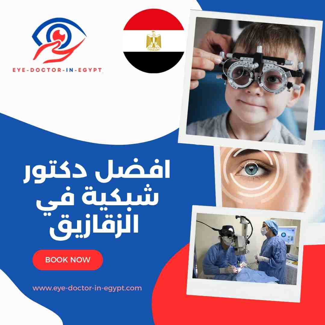 افضل دكتور شبكية في الزقازيق