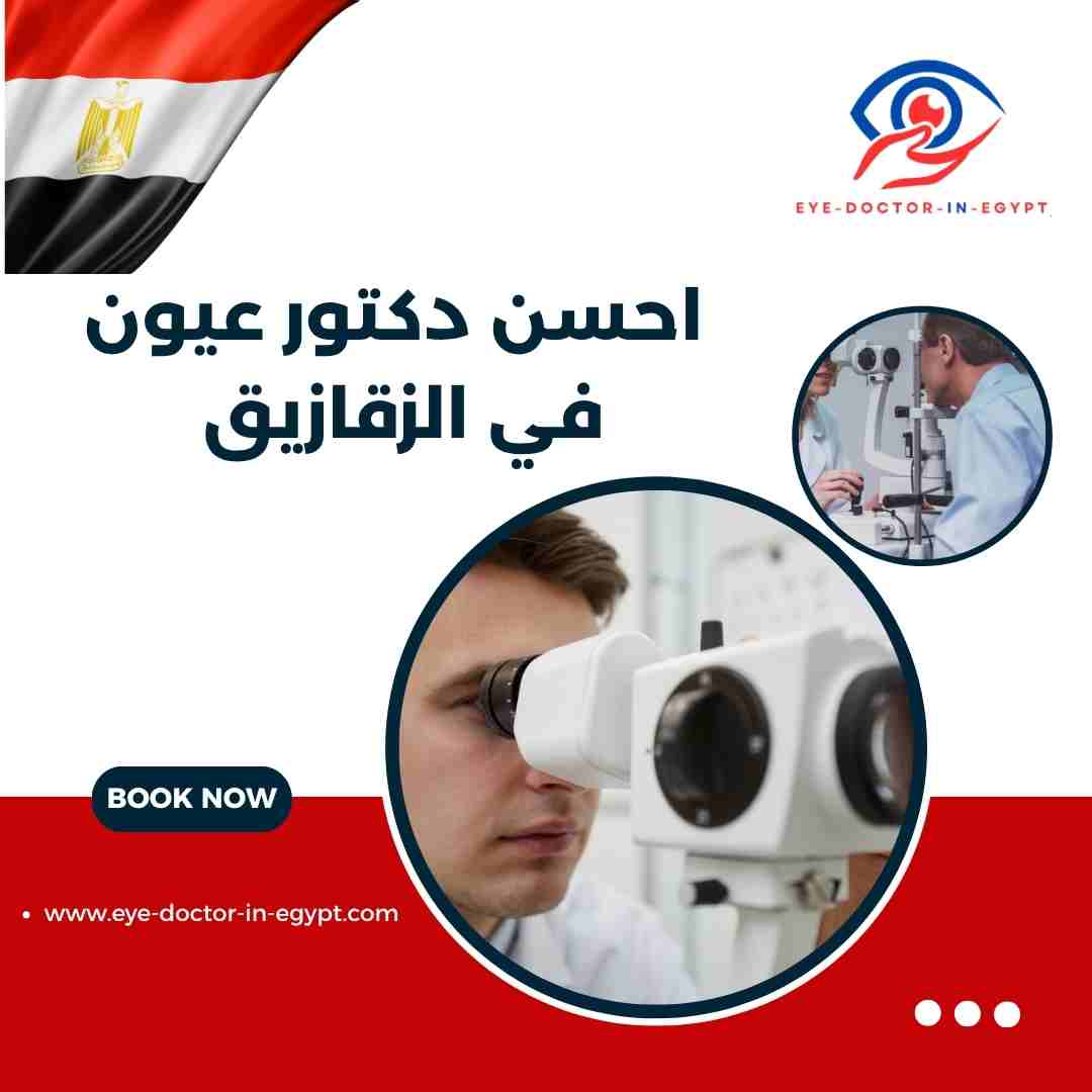 احسن دكتور عيون في الزقازيق