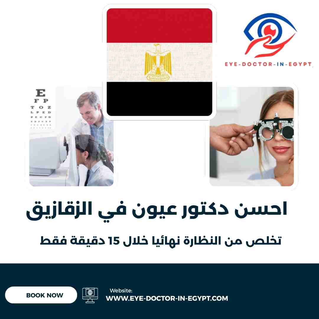 احسن دكتور عيون في الزقازيق