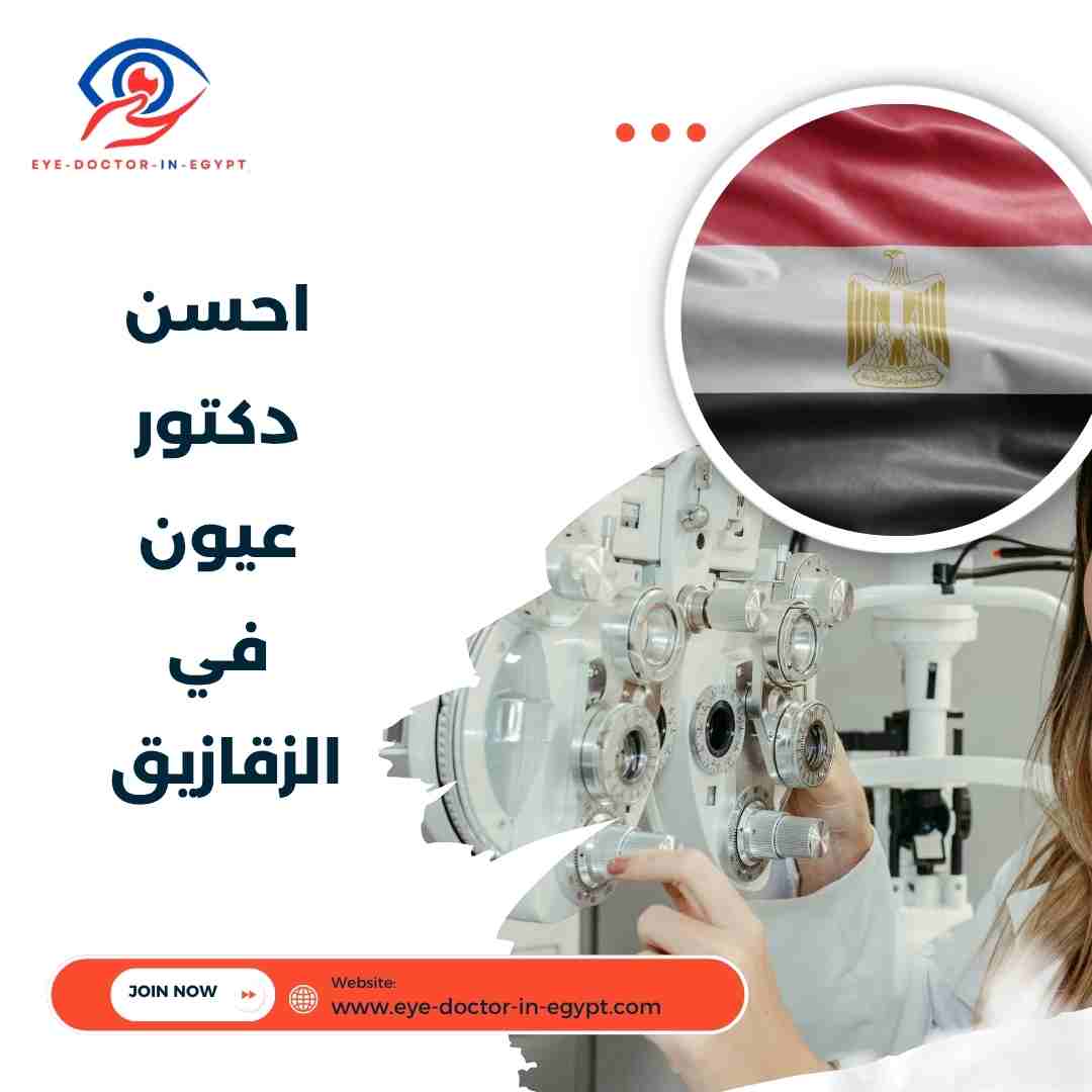 احسن دكتور عيون في الزقازيق