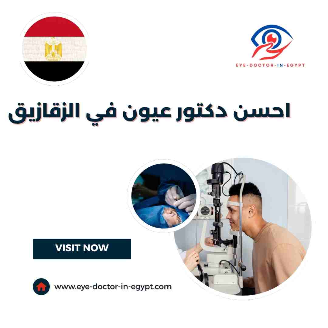 احسن دكتور عيون في الزقازيق