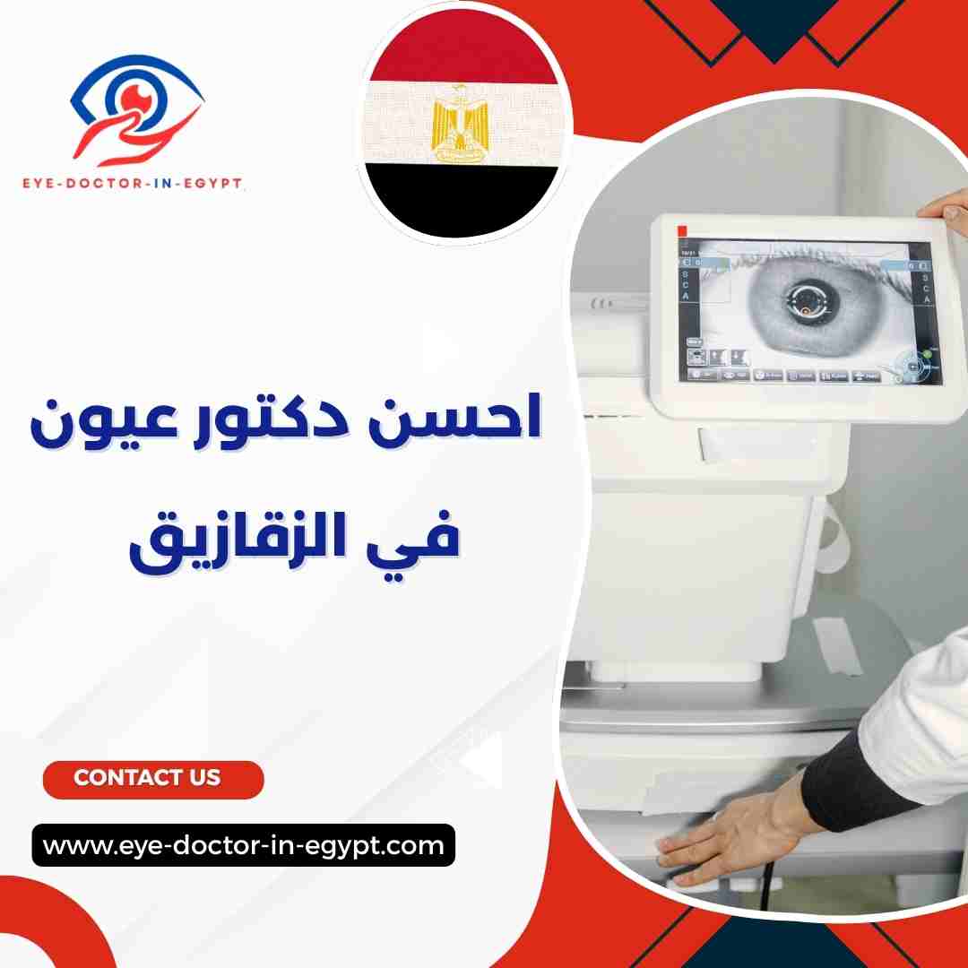 احسن دكتور عيون في الزقازيق