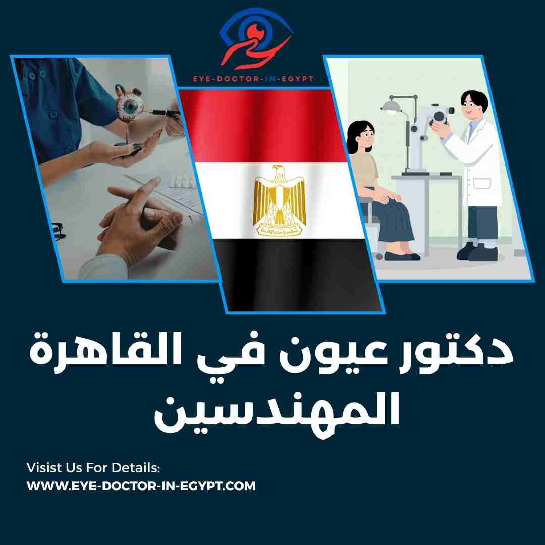 دكتور عيون في القاهرة المهندسين