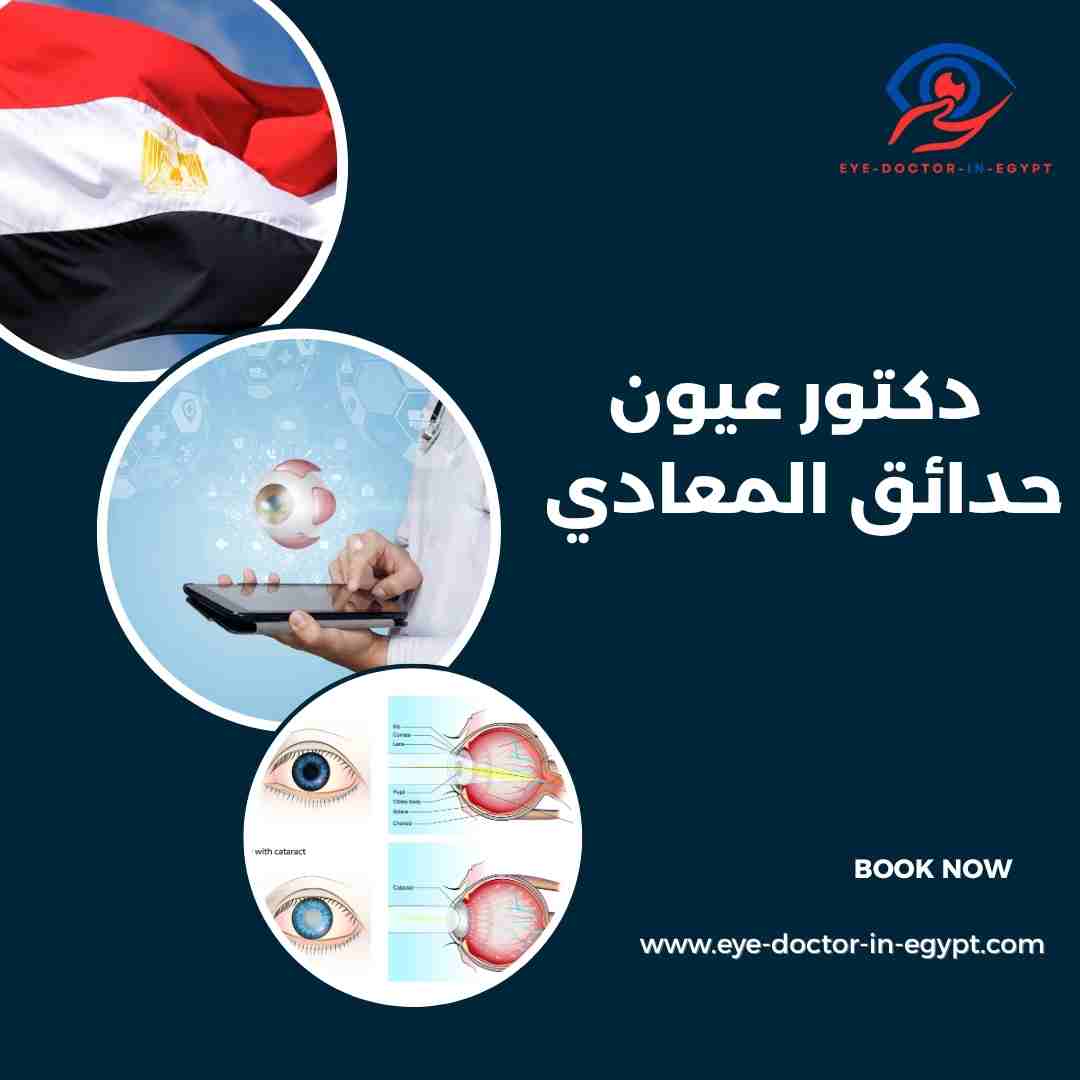 دكتور عيون حدائق المعادي