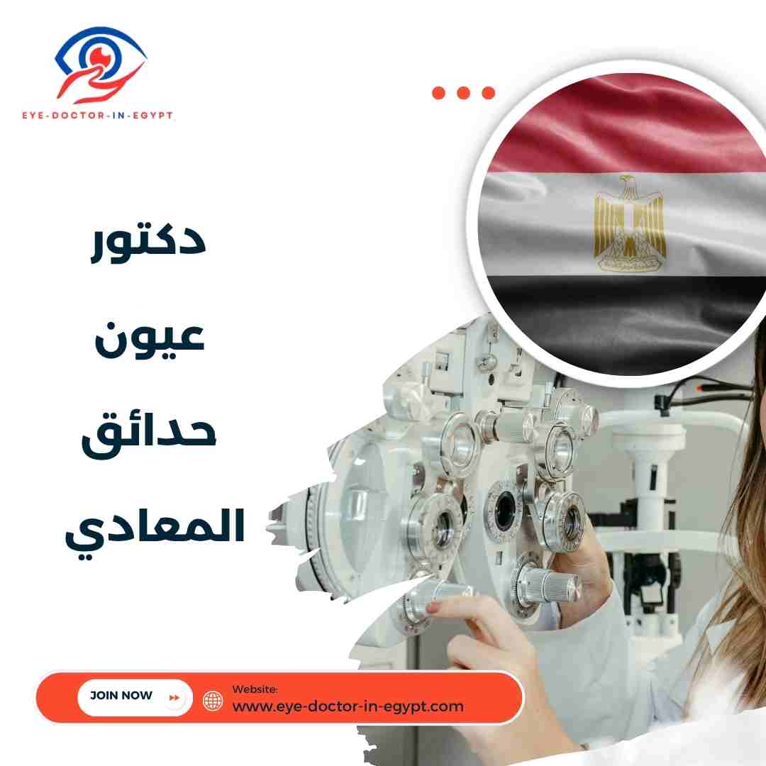 دكتور عيون حدائق المعادي