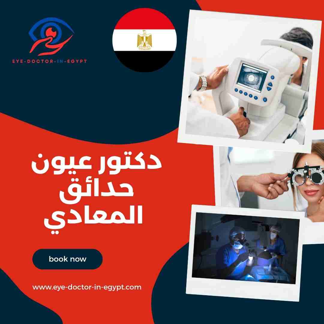 دكتور عيون حدائق المعادي