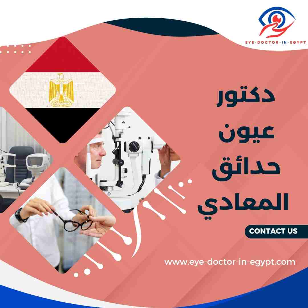 دكتور عيون حدائق المعادي