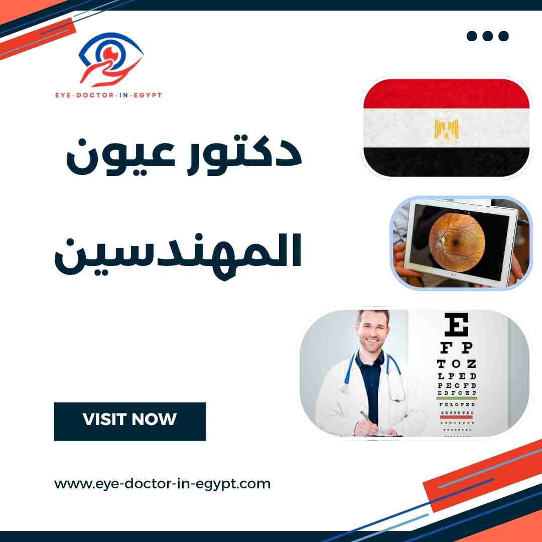 دكتور عيون المهندسين
