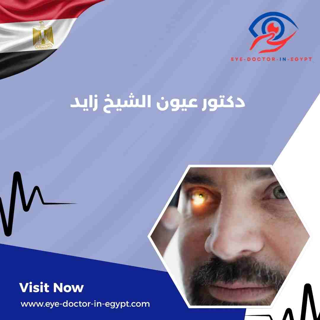 دكتور عيون الشيخ زايد