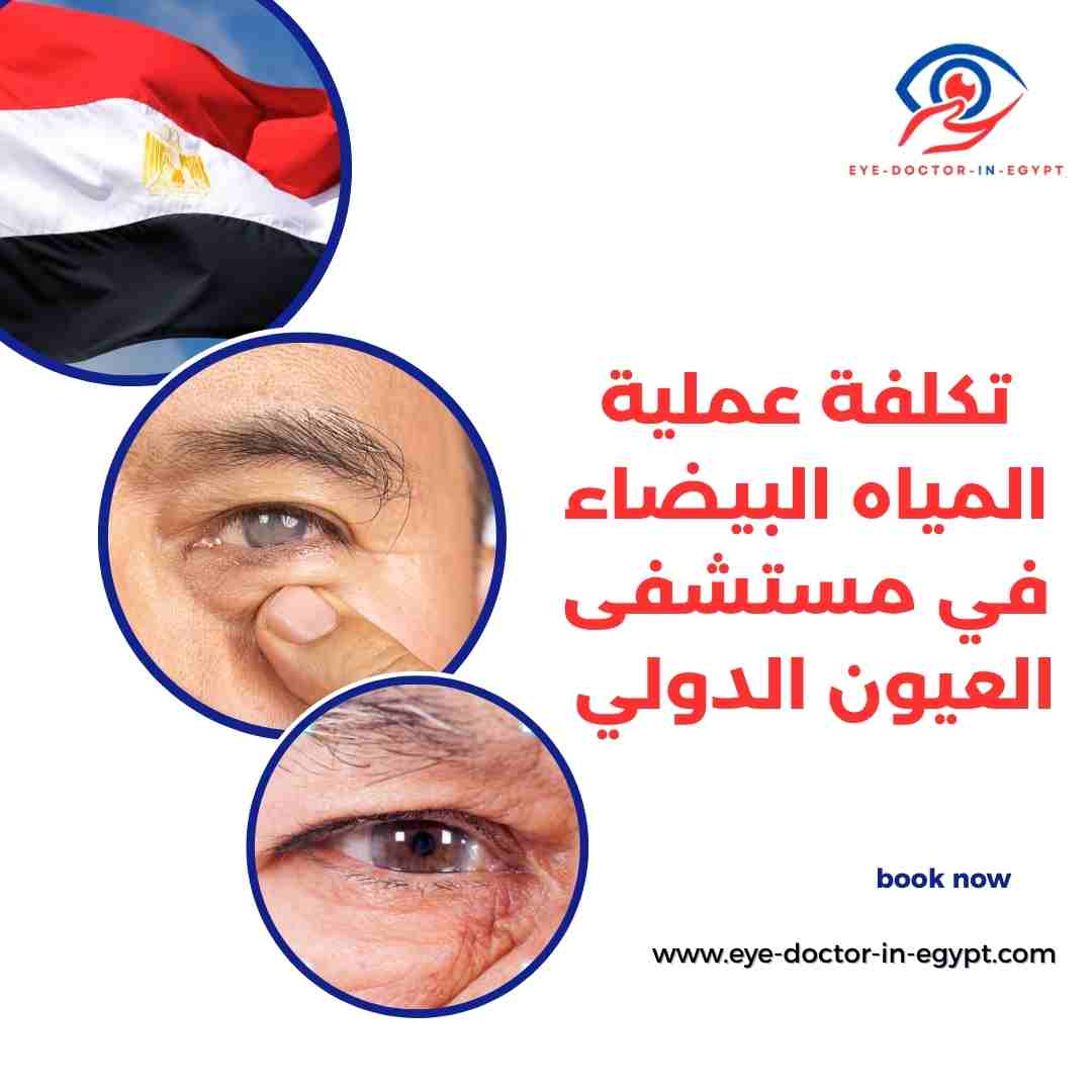 تكلفة عملية المياه البيضاء في مستشفى العيون الدولي