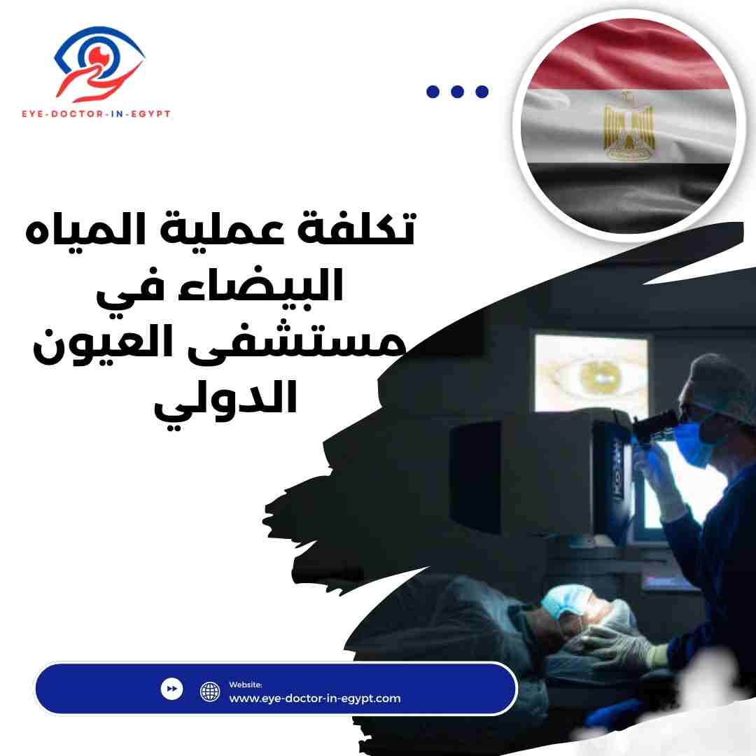 تكلفة عملية المياه البيضاء في مستشفى العيون الدولي