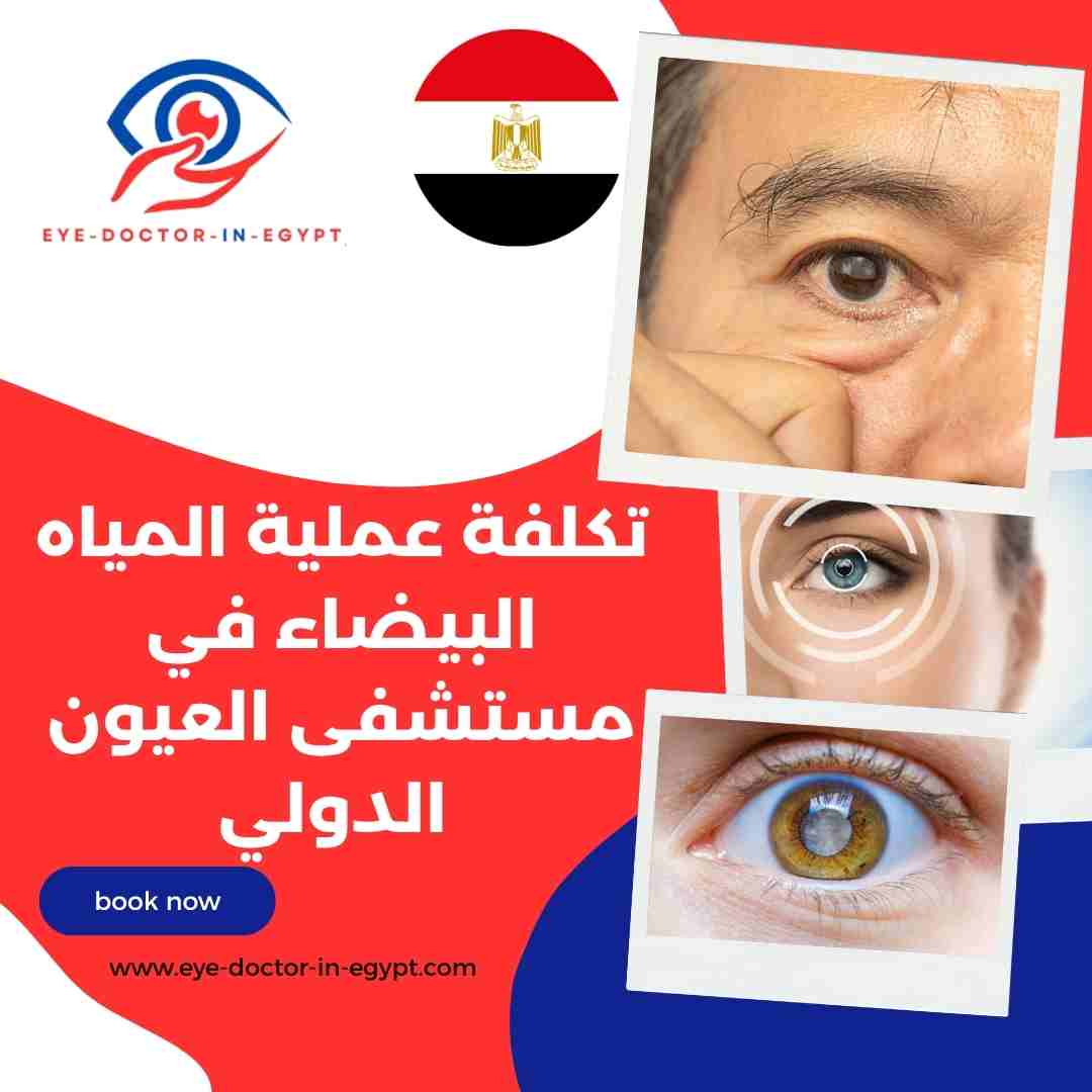 تكلفة عملية المياه البيضاء في مستشفى العيون الدولي