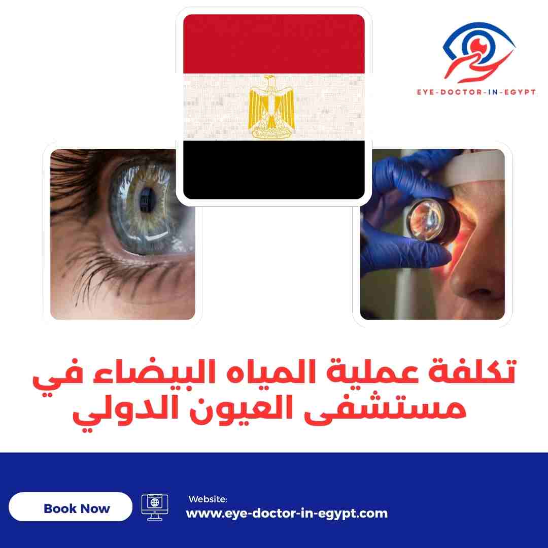 تكلفة عملية المياه البيضاء في مستشفى العيون الدولي