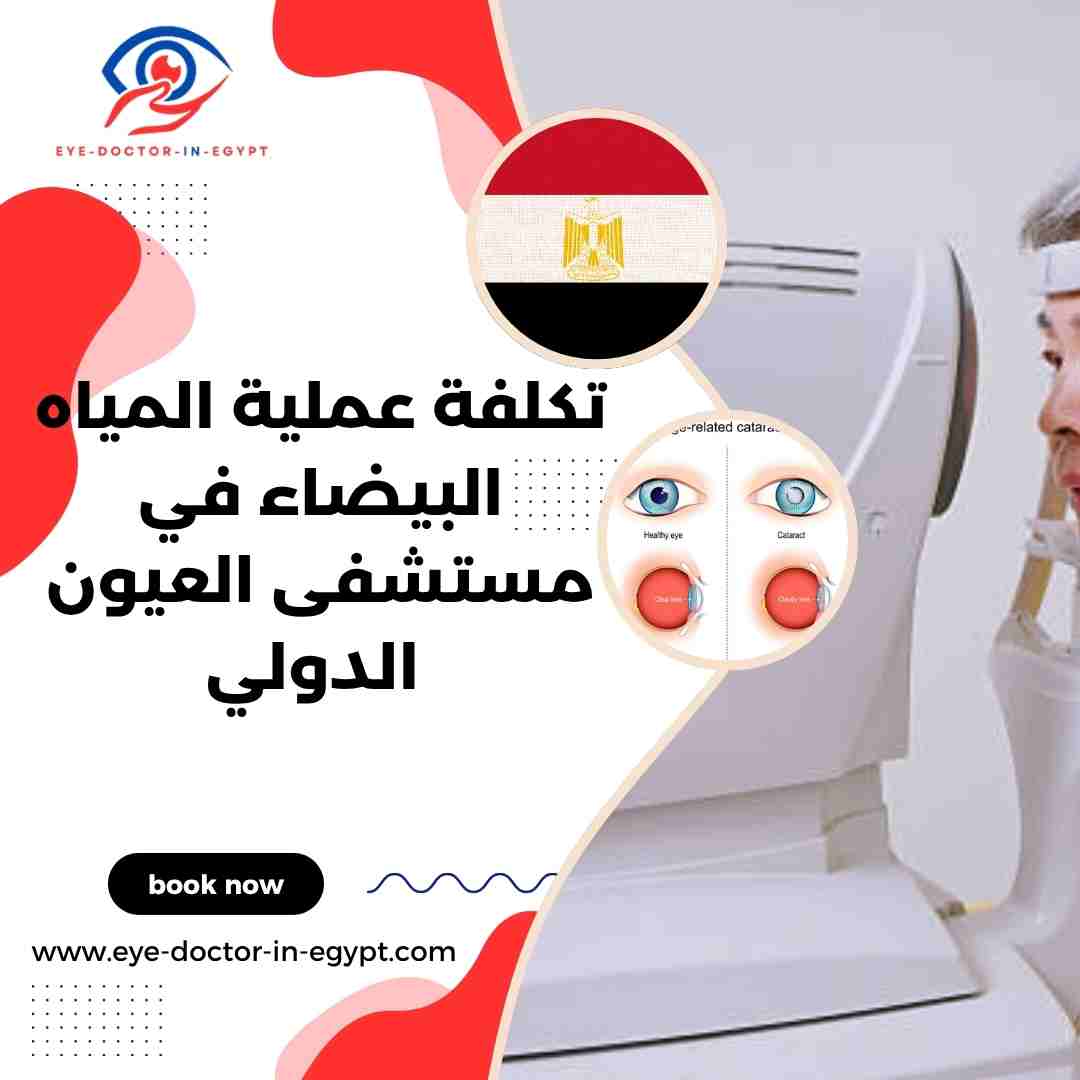 تكلفة عملية المياه البيضاء في مستشفى العيون الدولي