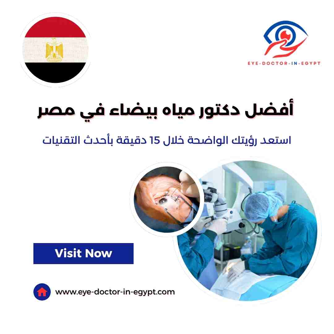 أفضل دكتور مياه بيضاء في مصر